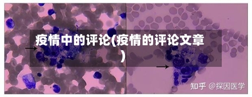 疫情中的评论(疫情的评论文章)-第3张图片