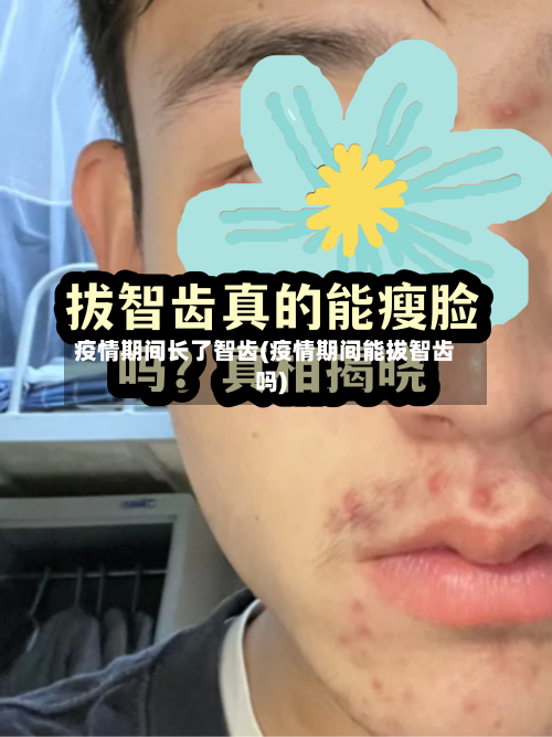 疫情期间长了智齿(疫情期间能拔智齿吗)-第2张图片