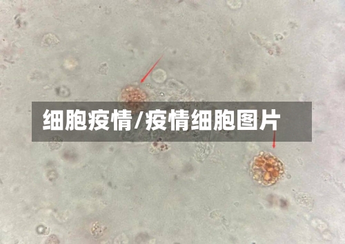 细胞疫情/疫情细胞图片-第2张图片
