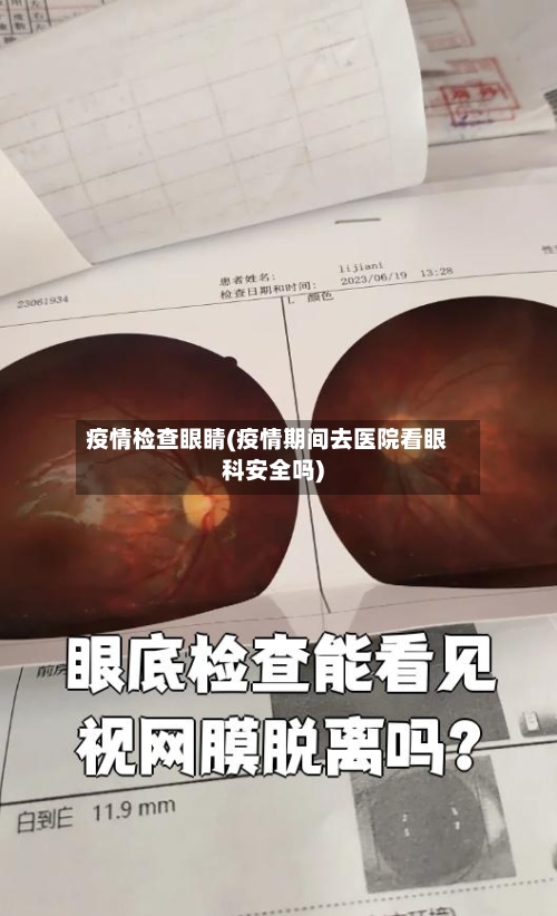 疫情检查眼睛(疫情期间去医院看眼科安全吗)-第2张图片