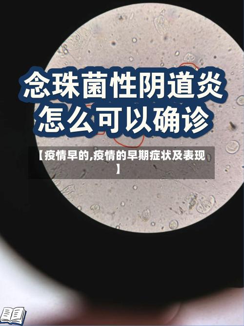 【疫情早的,疫情的早期症状及表现】