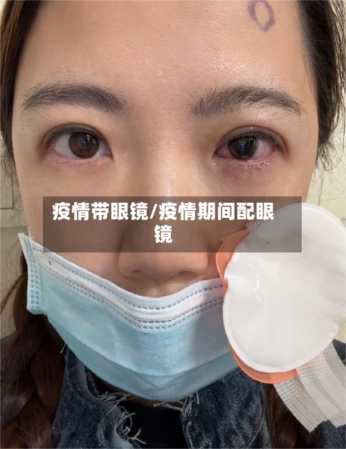 疫情带眼镜/疫情期间配眼镜