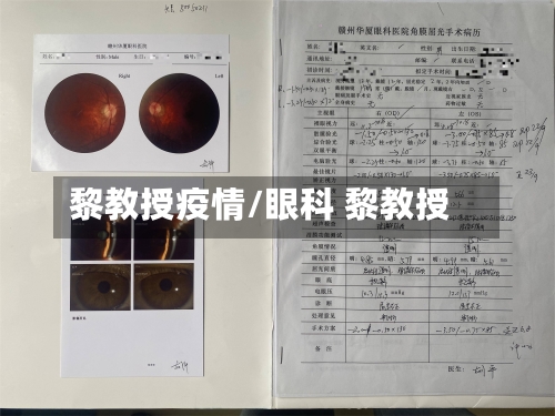 黎教授疫情/眼科 黎教授