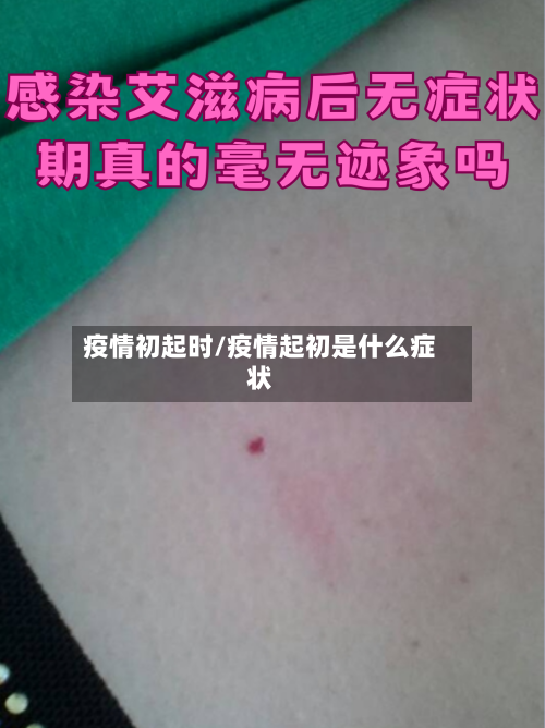 疫情初起时/疫情起初是什么症状