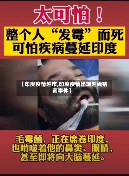 【印度疫情超市,印度疫情出现超级病菌事件】-第3张图片