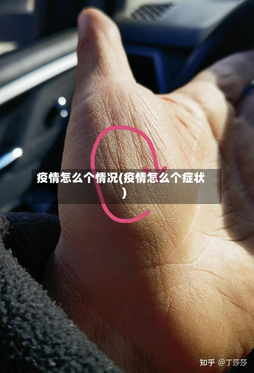 疫情怎么个情况(疫情怎么个症状)