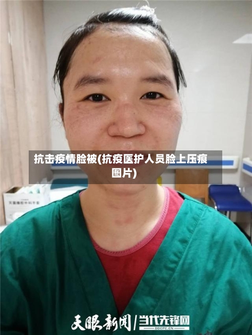 抗击疫情脸被(抗疫医护人员脸上压痕图片)